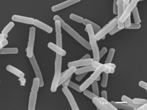 PA-3乳酸菌 電子顕微鏡写真　出典：http://www.meiji.co.jp/yogurtlibrary/laboratory/report/pa-3/02/
