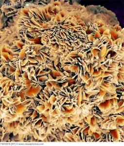 失神するほどの激痛。尿道結石の予防法とは！？