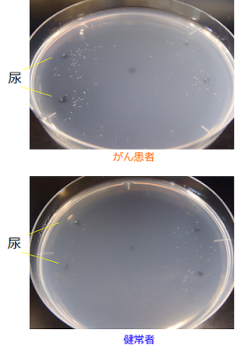 出典：http://news.sci.kyushu-u.ac.jp/biol/%E7%B7%9A%E8%99%AB%E3%81%A7%EF%BC%91%EF%BC%90%EF%BC%90%E5%86%86%E3%81%8C%E3%82%93%E6%A4%9C%E6%9F%BB/