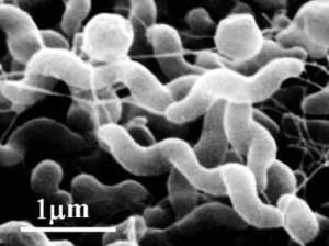 カンピロバクター食中毒になった時の治療法と潜伏期間