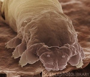 ニキビダニの宿命が気の毒過ぎる。肛門を持たず２週間で食べ過ぎて破裂