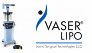 確実な二の腕の脂肪吸引ならVASER（ベイザー）が良い！？最新の脂肪吸引を紹介